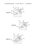 METHODS AND APPARATUSES FOR PERFORMING AND MONITORING THERMAL ABLATION diagram and image