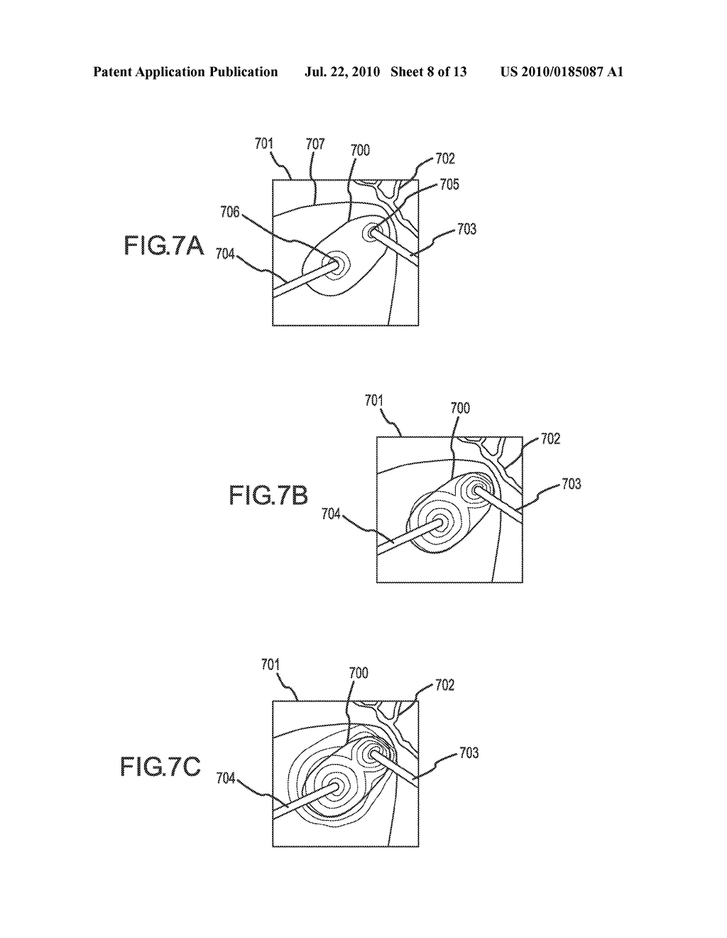 METHODS AND APPARATUSES FOR PERFORMING AND MONITORING THERMAL ABLATION - diagram, schematic, and image 09