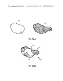 METHODS AND APPARATUSES FOR PERFORMING AND MONITORING THERMAL ABLATION diagram and image