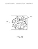 METHODS AND APPARATUSES FOR PERFORMING AND MONITORING THERMAL ABLATION diagram and image