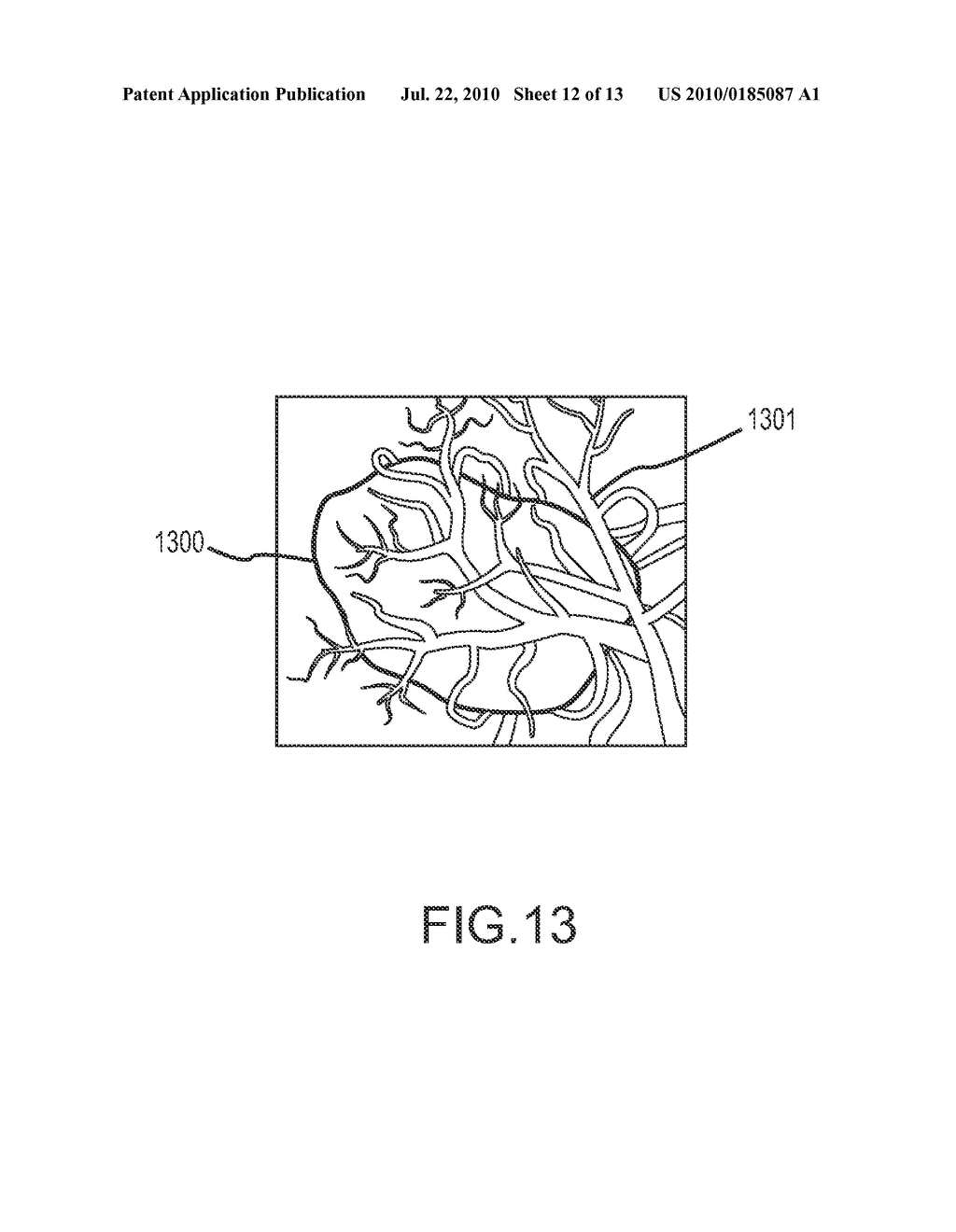 METHODS AND APPARATUSES FOR PERFORMING AND MONITORING THERMAL ABLATION - diagram, schematic, and image 13