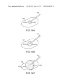 METHODS AND APPARATUSES FOR PERFORMING AND MONITORING THERMAL ABLATION diagram and image