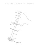 Enteral Feeding Assembly With Obturator diagram and image