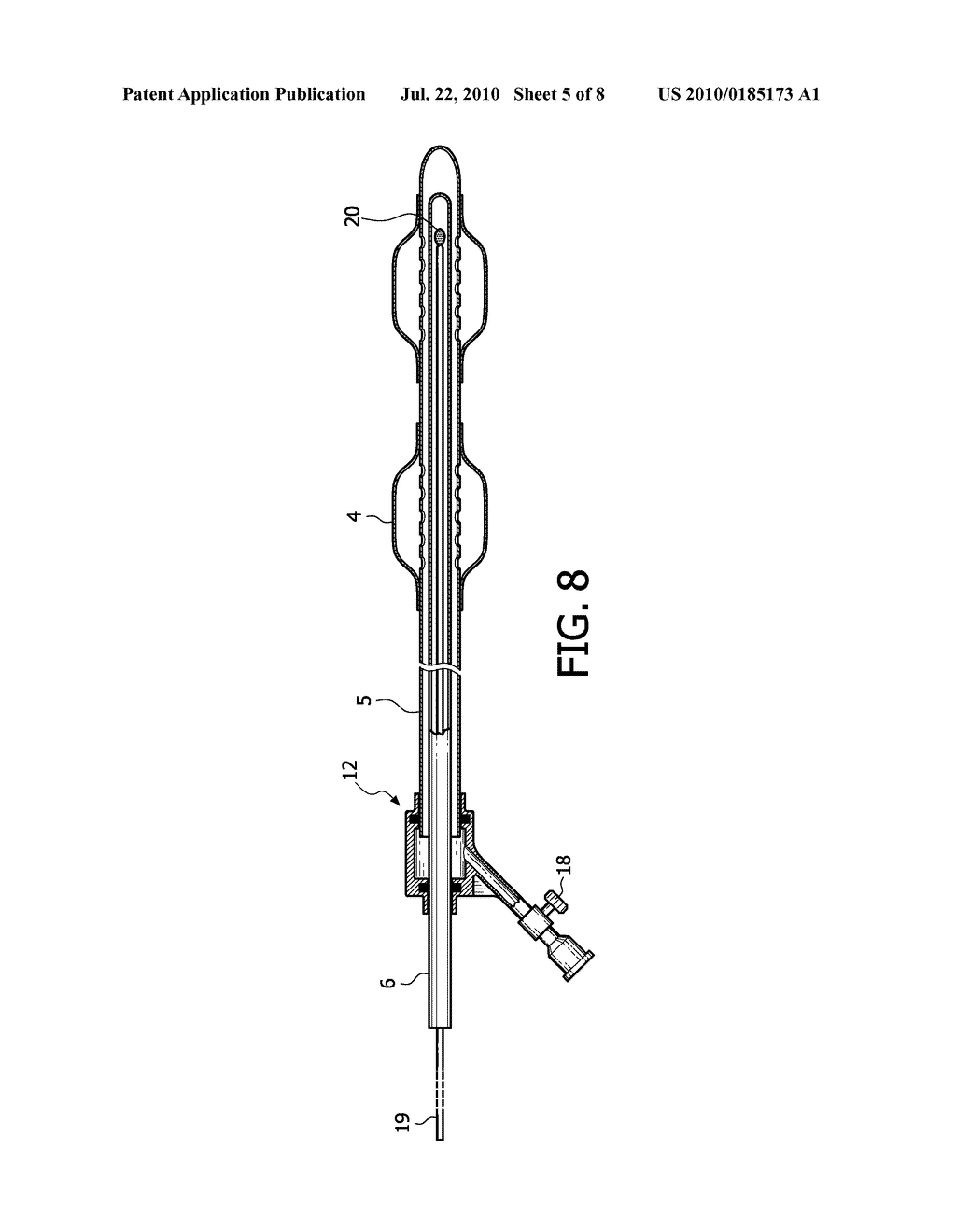 METHOD AND KIT FOR DELIVERY OF BRACHYTHERAPY TO A SUBJECT - diagram, schematic, and image 06