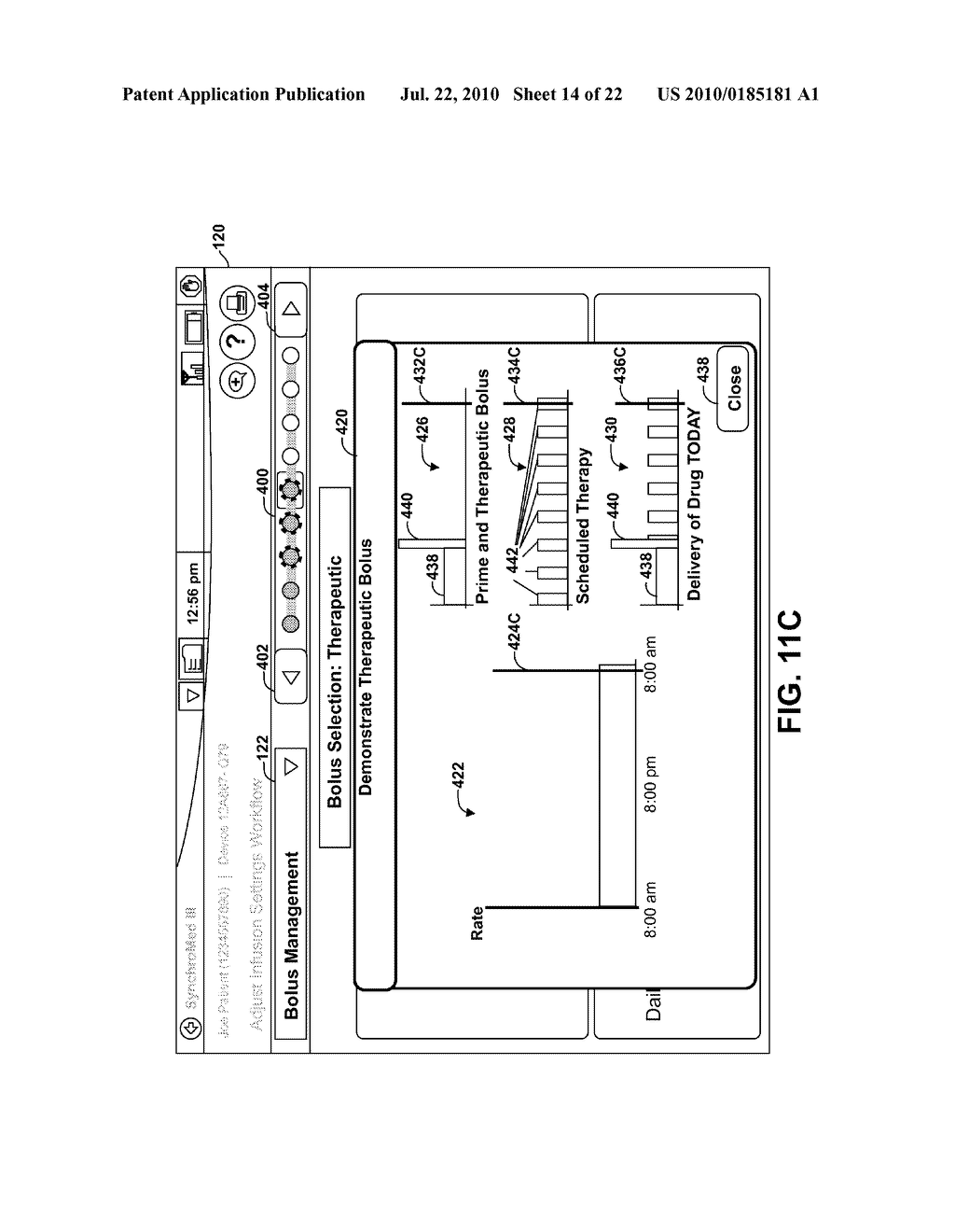 DISPLAY OF SUPPLEMENTAL BOLUS IN RELATION TO PROGRAMMED DOSE - diagram, schematic, and image 15