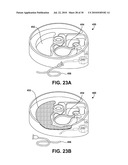 USER INTERFACE INDICATING FLUID LOCATION FOR AN IMPLANTABLE FLUID DELIVERY DEVICE diagram and image