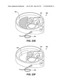 USER INTERFACE INDICATING FLUID LOCATION FOR AN IMPLANTABLE FLUID DELIVERY DEVICE diagram and image