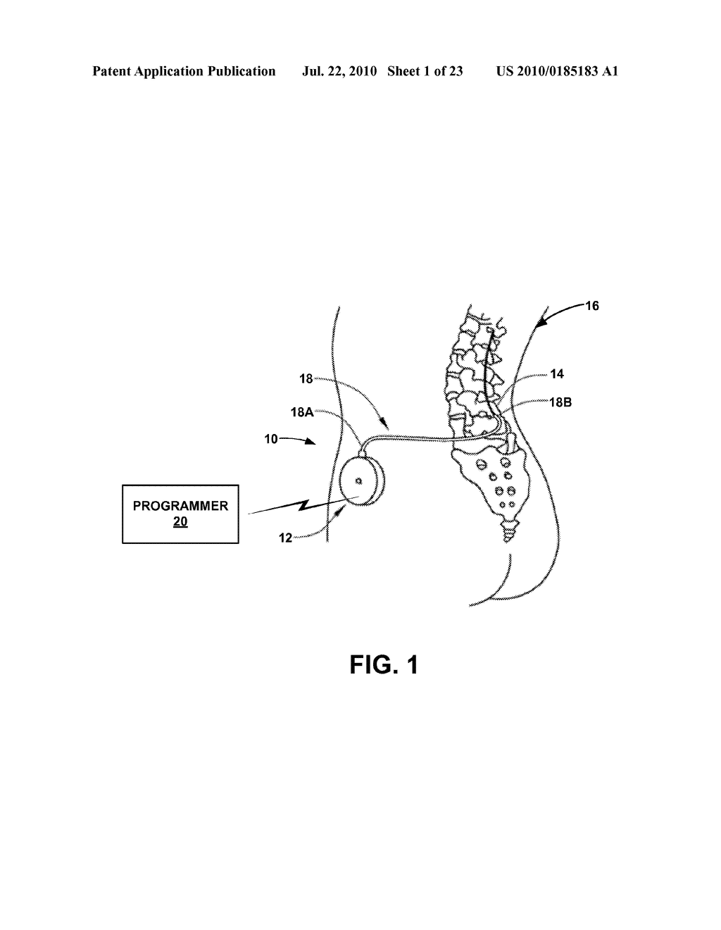 USER INTERFACE THAT DISPLAYS PENDING AND SELECTED PROGRAMMING FOR AN IMPLANTABLE MEDICAL DEVICE - diagram, schematic, and image 02