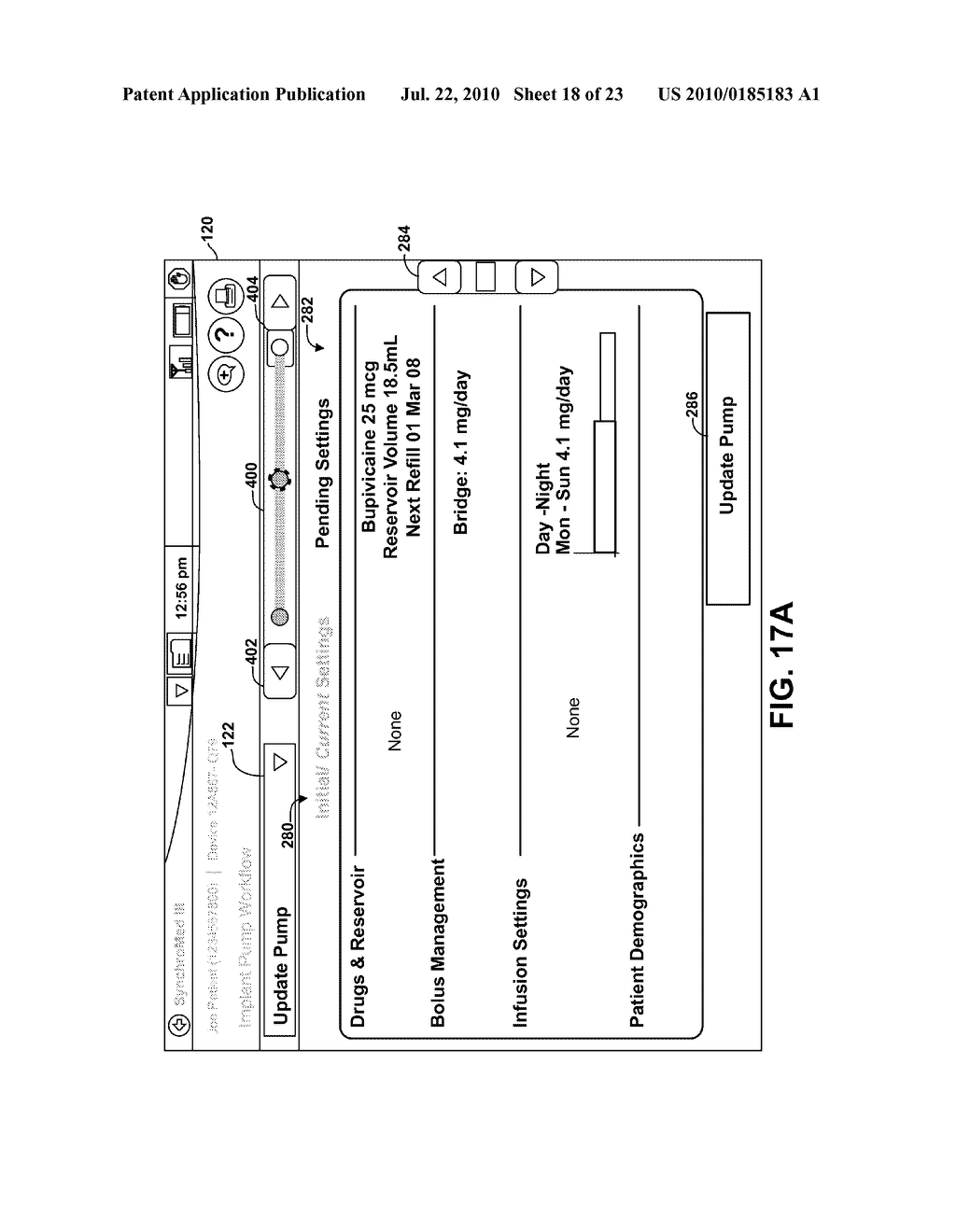 USER INTERFACE THAT DISPLAYS PENDING AND SELECTED PROGRAMMING FOR AN IMPLANTABLE MEDICAL DEVICE - diagram, schematic, and image 19