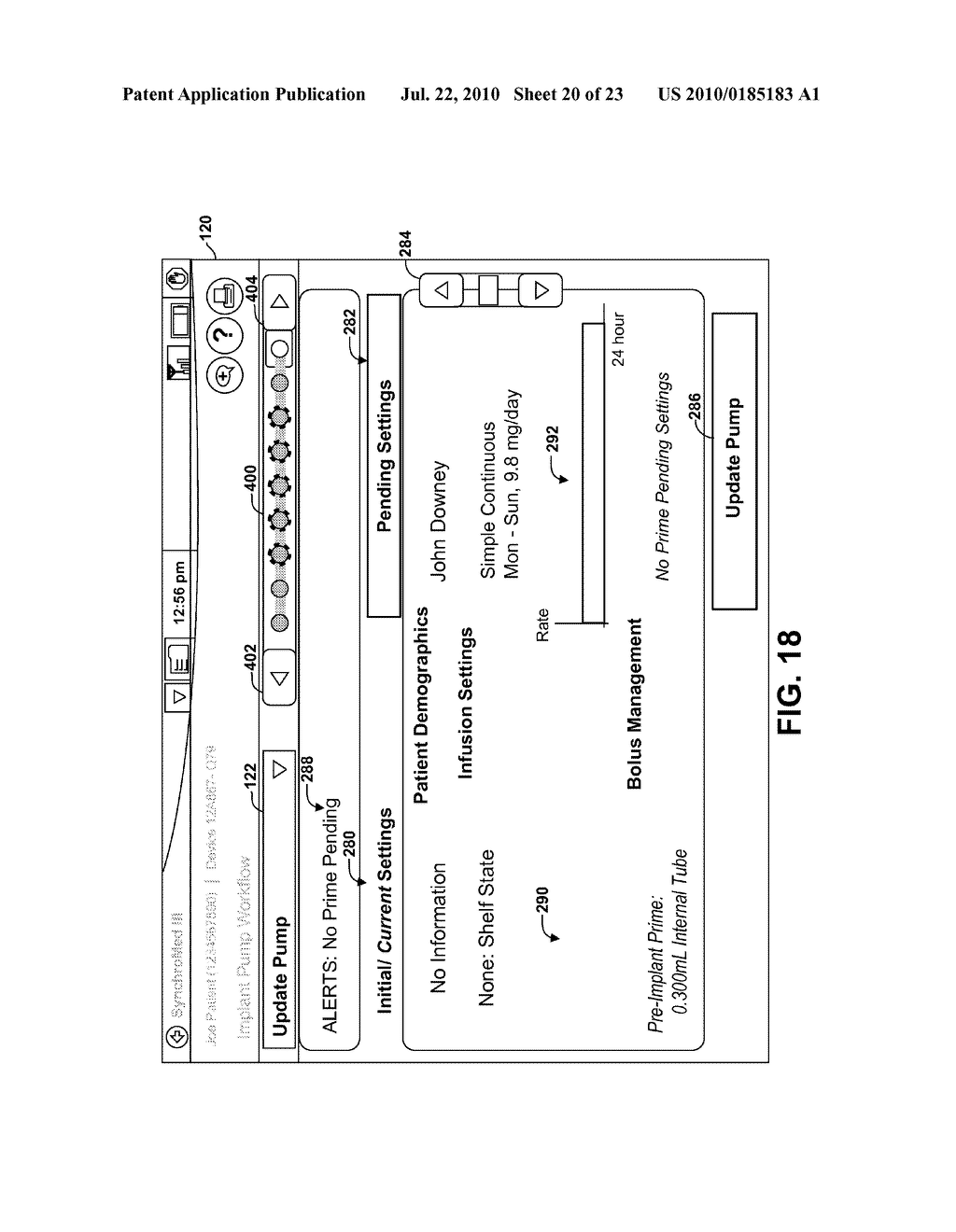 USER INTERFACE THAT DISPLAYS PENDING AND SELECTED PROGRAMMING FOR AN IMPLANTABLE MEDICAL DEVICE - diagram, schematic, and image 21