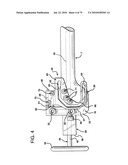 FEMORAL PROSTHETIC IMPLANT diagram and image