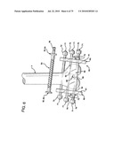 FEMORAL PROSTHETIC IMPLANT diagram and image