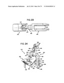 FEMORAL PROSTHETIC IMPLANT diagram and image