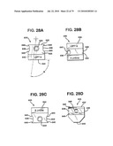 FEMORAL PROSTHETIC IMPLANT diagram and image