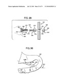 FEMORAL PROSTHETIC IMPLANT diagram and image