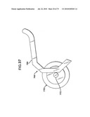 FEMORAL PROSTHETIC IMPLANT diagram and image