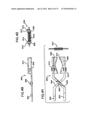 FEMORAL PROSTHETIC IMPLANT diagram and image