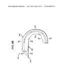 FEMORAL PROSTHETIC IMPLANT diagram and image