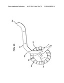 FEMORAL PROSTHETIC IMPLANT diagram and image