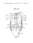 FEMORAL PROSTHETIC IMPLANT diagram and image