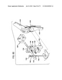 FEMORAL PROSTHETIC IMPLANT diagram and image