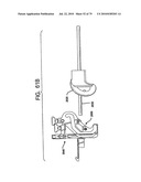 FEMORAL PROSTHETIC IMPLANT diagram and image