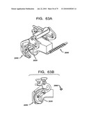 FEMORAL PROSTHETIC IMPLANT diagram and image