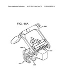 FEMORAL PROSTHETIC IMPLANT diagram and image