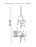 FEMORAL PROSTHETIC IMPLANT diagram and image