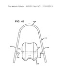 FEMORAL PROSTHETIC IMPLANT diagram and image