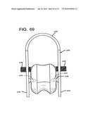 FEMORAL PROSTHETIC IMPLANT diagram and image