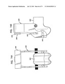 FEMORAL PROSTHETIC IMPLANT diagram and image