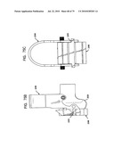 FEMORAL PROSTHETIC IMPLANT diagram and image