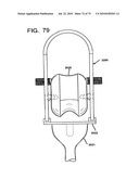 FEMORAL PROSTHETIC IMPLANT diagram and image