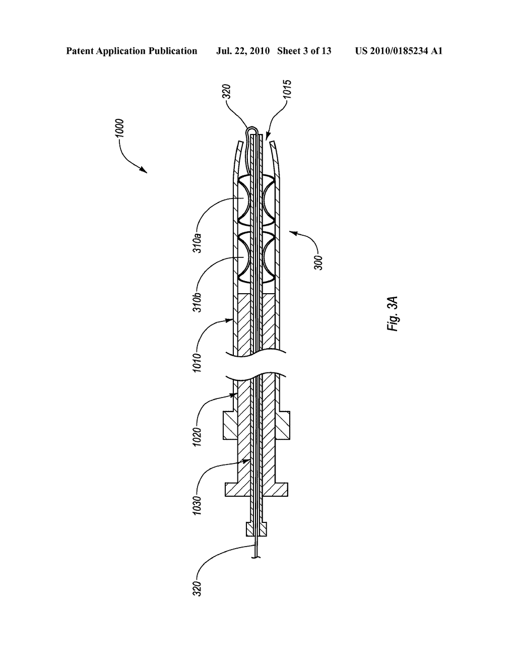 CLOSURE DEVICES, SYSTEMS, AND METHODS - diagram, schematic, and image 04