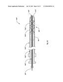 CLOSURE DEVICES, SYSTEMS, AND METHODS diagram and image