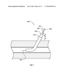 CLOSURE DEVICES, SYSTEMS, AND METHODS diagram and image