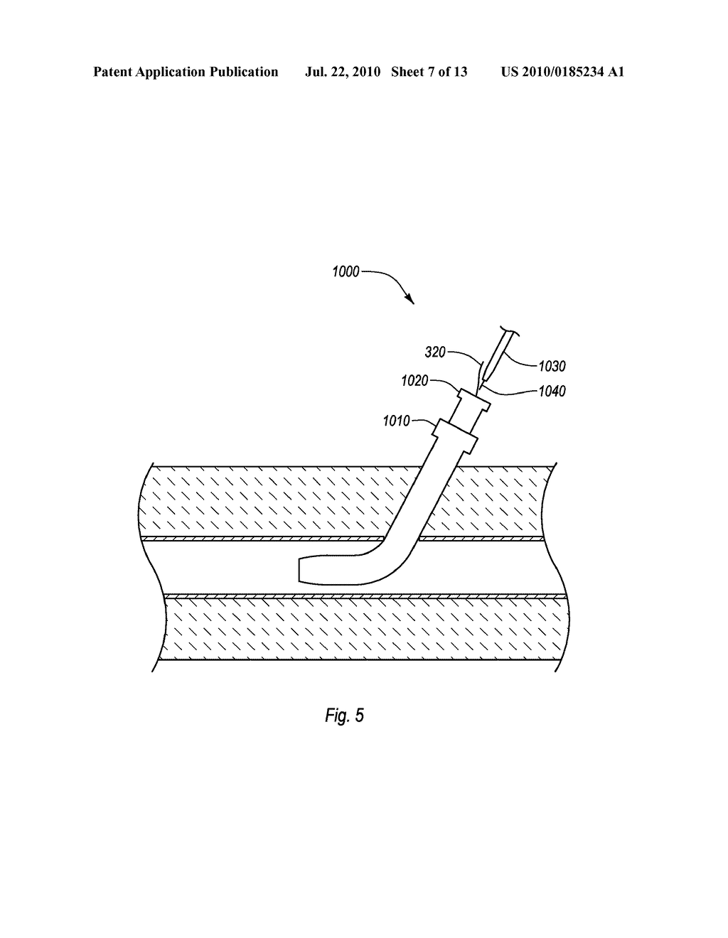 CLOSURE DEVICES, SYSTEMS, AND METHODS - diagram, schematic, and image 08