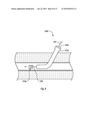 CLOSURE DEVICES, SYSTEMS, AND METHODS diagram and image