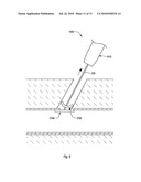 CLOSURE DEVICES, SYSTEMS, AND METHODS diagram and image