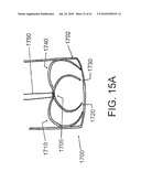 SYSTEMS AND METHODS FOR CLOSING AN APERTURE IN A BODILY TISSUE diagram and image