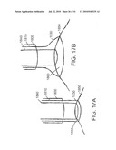 SYSTEMS AND METHODS FOR CLOSING AN APERTURE IN A BODILY TISSUE diagram and image