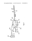 SYSTEMS AND METHODS FOR CLOSING AN APERTURE IN A BODILY TISSUE diagram and image