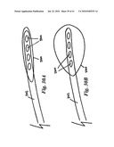 SYSTEMS AND METHODS FOR CLOSING AN APERTURE IN A BODILY TISSUE diagram and image