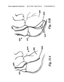 SYSTEMS AND METHODS FOR CLOSING AN APERTURE IN A BODILY TISSUE diagram and image