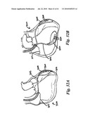 SYSTEMS AND METHODS FOR CLOSING AN APERTURE IN A BODILY TISSUE diagram and image