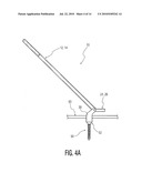 Rod Coercer diagram and image