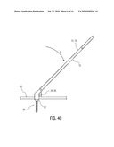 Rod Coercer diagram and image