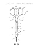 Rod Coercer diagram and image