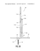 Rod Coercer diagram and image